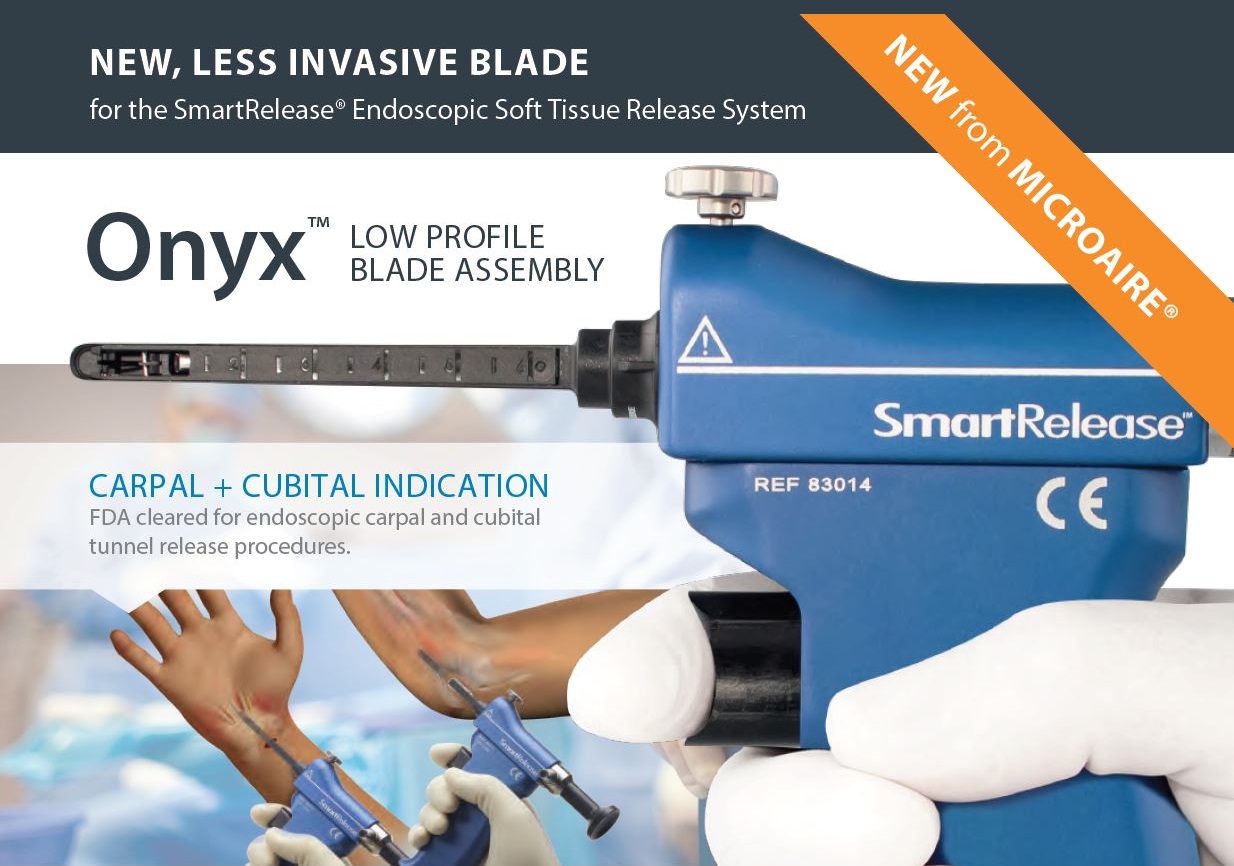 Endoscopic Carpal & Cubital Tunnel Release